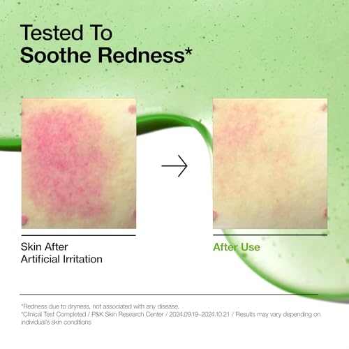 Anua Soothing & Barrier Support Duo | Azelaic Acid Serum For Face with Ceramide Barrier Moisturizer, Spot Care & Calming Effect, Korean Skincare Set