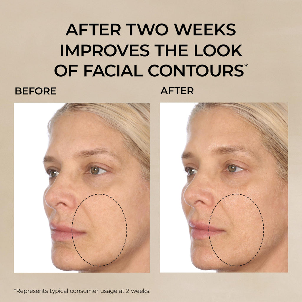 Elizabeth Arden Retinol + HPR Ceramide Rapid Skin Renewing Anti-Aging Face Serum Capsules, Fine Lines & Wrinkles Treatment with Peptides, Vitamin E, & Niacinamide